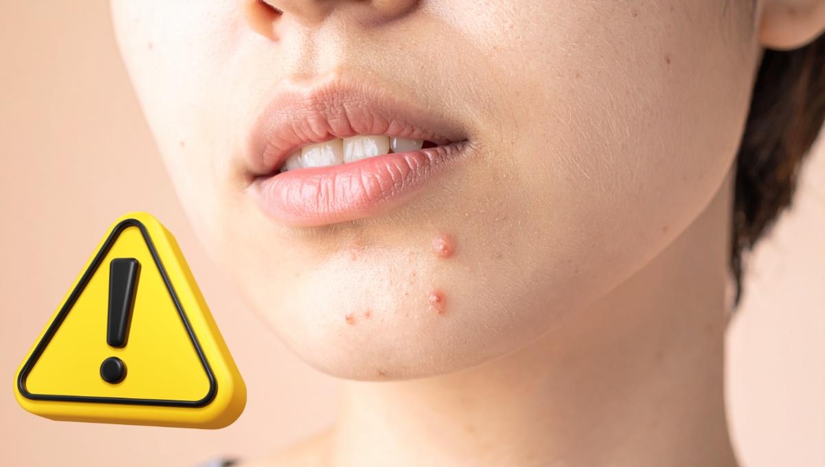 El triángulo de la muerte: qué es, cómo afecta a tu piel y a tu salud en general